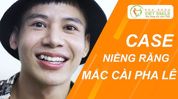 Giá răng mắc cài pha lê - Niềng răng khểnh ở đâu?
