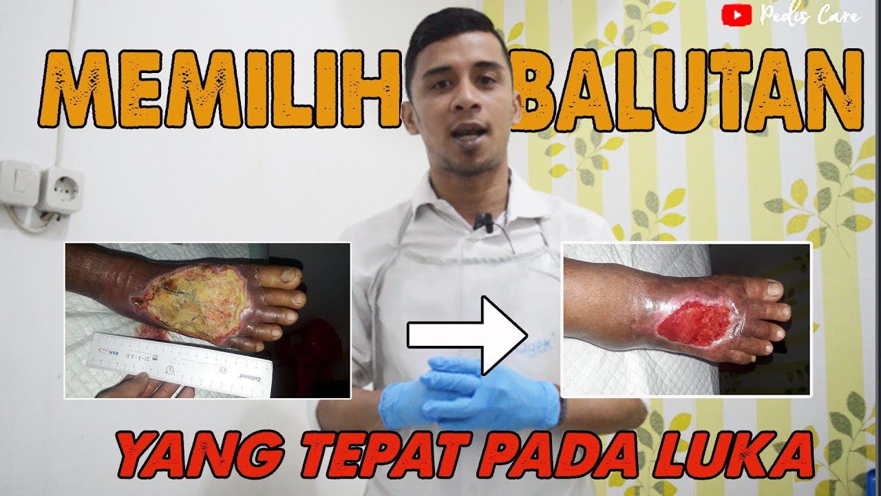Penanganan luka penderita Diabetes part 4 II Tips dan Trik Memilih