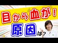 目から出血!繰り返すときは要注意!その原因と対策がわかります