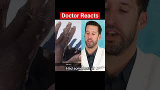 ER Doctor REACTS to Hand Peeling Off