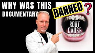 BANNED Root Cause Documentary EXPLAINED (By a Biodentist)