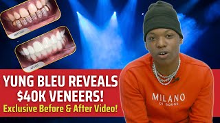 Yung Bleu Reveals $40K Veneers! [Exclusive Before and After Video]: Celebrity Smile News