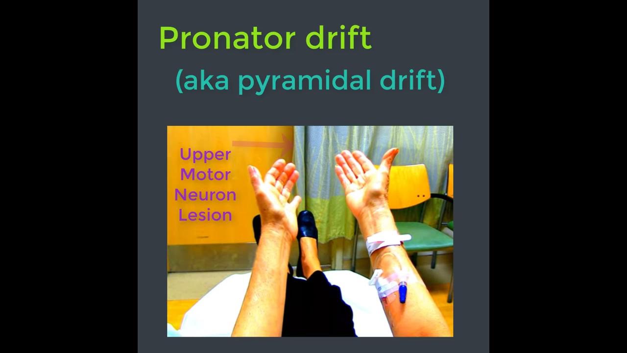 Pronator drift YouTube
