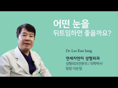 어떤 눈을 뒤트임 수술하면 좋을까요?