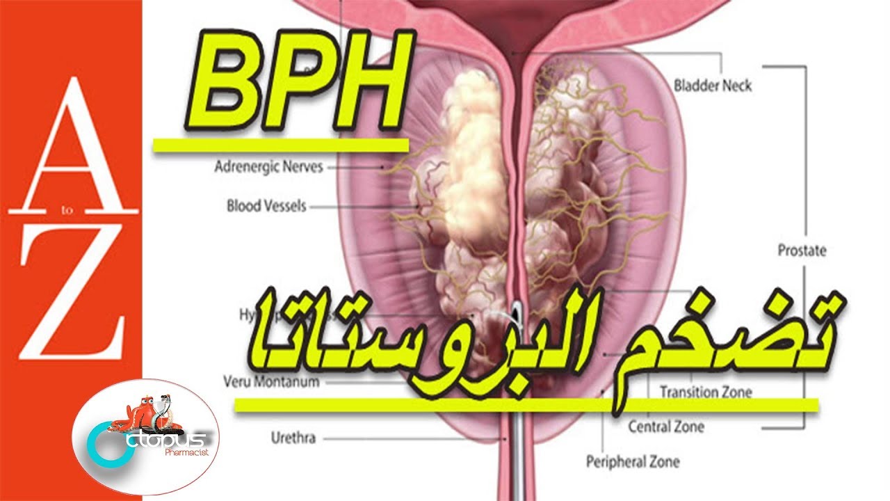 BPH 