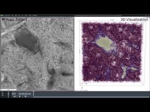 Portal triad in mouse liver