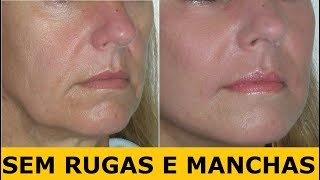 APENAS 3 GOTAS ANTES DE DORMIR E MANCHAS,RUGAS E CICATRIZES PROFUNDAS DESAPARECERÃƒO!