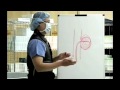 Tom L. Yao M.D. explains the procedure of coiling an aneurysm