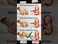 Stress points on fetus during sleeping#shortsfeed#shorts#pragnent#pregnancy#viralvide#1millionviews