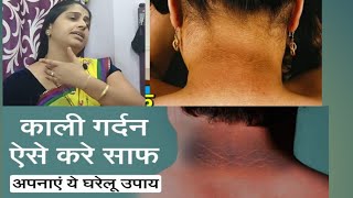 कल गरदन स छटकर मतर 15 मनट म घरल उपय How To Remove Dark Neck कल गरदन क कस सफ