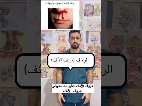 الرعاف نزيف الأنف الرعاف نزيف انف  صحتك أهم معلومات صحية معلومات طبية طبيب طب