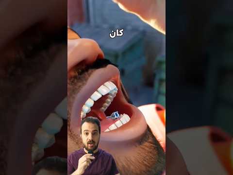 حرامي سرق المجوهرات وبلعهم