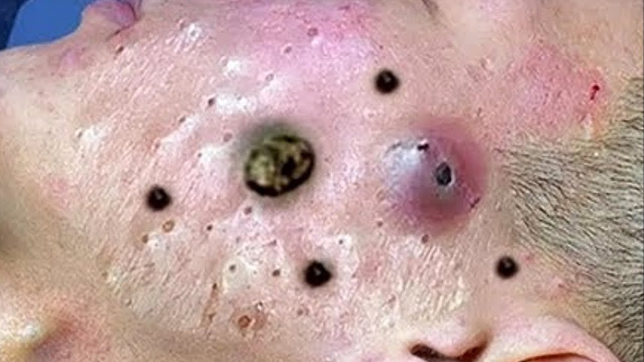 𝐂𝐡𝐢𝐥𝐥 𝐘𝐨𝐮𝐫 𝐋𝐢𝐟𝐞 𝐖𝐢𝐭𝐡 𝐋𝐍𝐆 𝐒𝐤𝐢𝐧 𝐂𝐚𝐫𝐞 