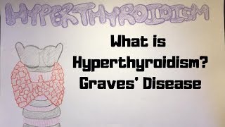 What is Hyperthyroidism? Graves&#39; Disease / Anatomy, Physiology, Pathology and Treatment