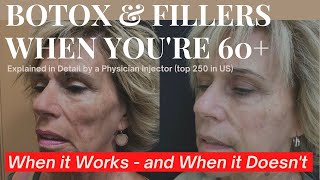 Botox \& Filler Over 60: When It Works \& When It Just Doesn't Cut It Anymore