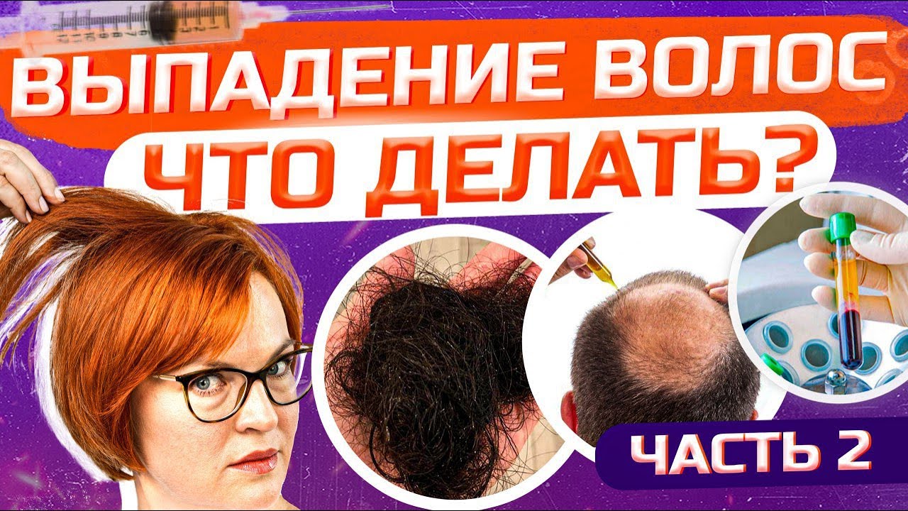 Выпадают волосы– как лечить? Часть 2. Косметолог Доктор Кобец - YouTube