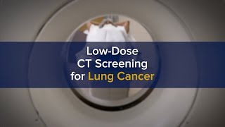 Early Low-Dose CT Screening Key to Curing Lung Cancer Through Advanced Treatment