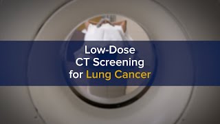 Early Low-Dose CT Screening Key to Curing Lung Cancer Through Advanced Treatment | UC Davis Health