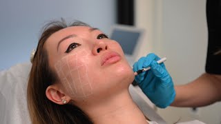 The Process Of Skinvive Injectable Skin Booster Treatment By Juvederm