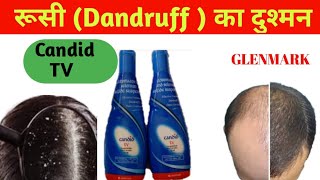 Candid Tv Suspension Review And Uses Best Anti - Dandruff Candid Tv......