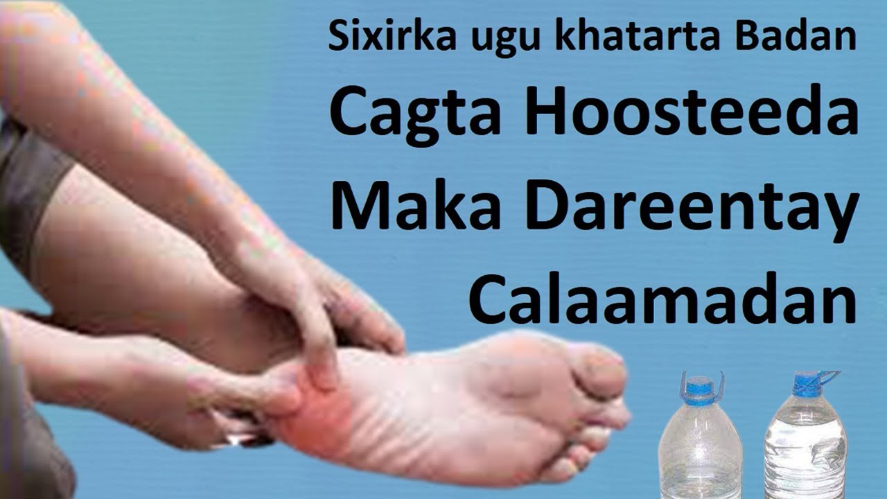 Sixirka ugu Halista Badan Cagta Hoosteeda calaamadan maku Aragtay ogow waxa ay tahay sida Locilajiyo