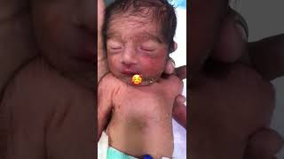 LBW BABY LOVE ❤️👨🏻‍⚕️ #nicubaby #baby #newmommyslifestyle #newborncare #mynewbaby