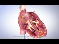 SinusFlex™ decapolar mapping catheter - Redefining CS placement