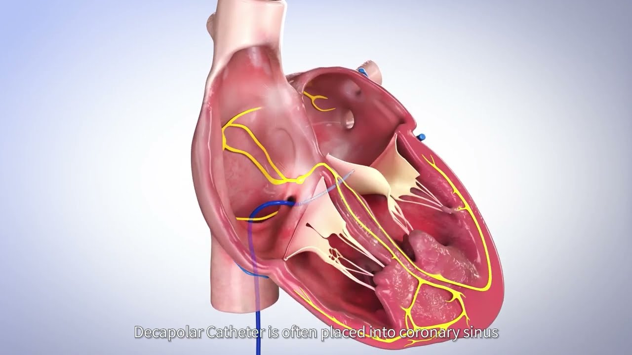 APT Medical Video Thumbnail