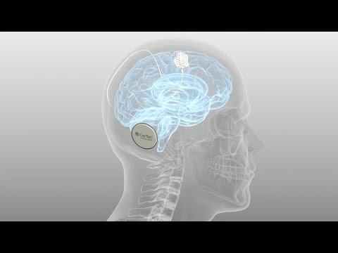 CorTec Brain Interchange System - Closed Loop Brain Computer Interface