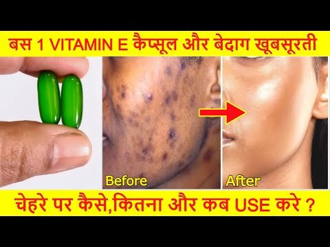 "Apply Vitamin E like this – Spots, pigmentation and wrinkles disappear"