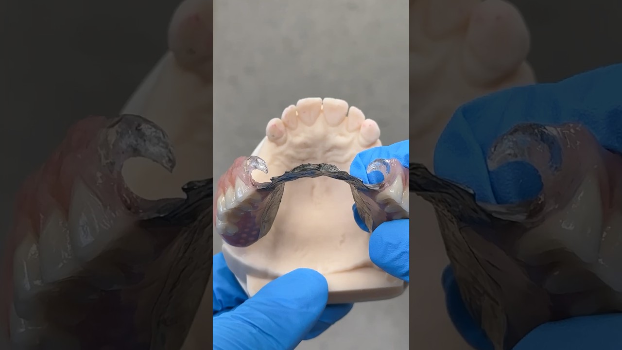 Metal Partial with Clear Clasps 