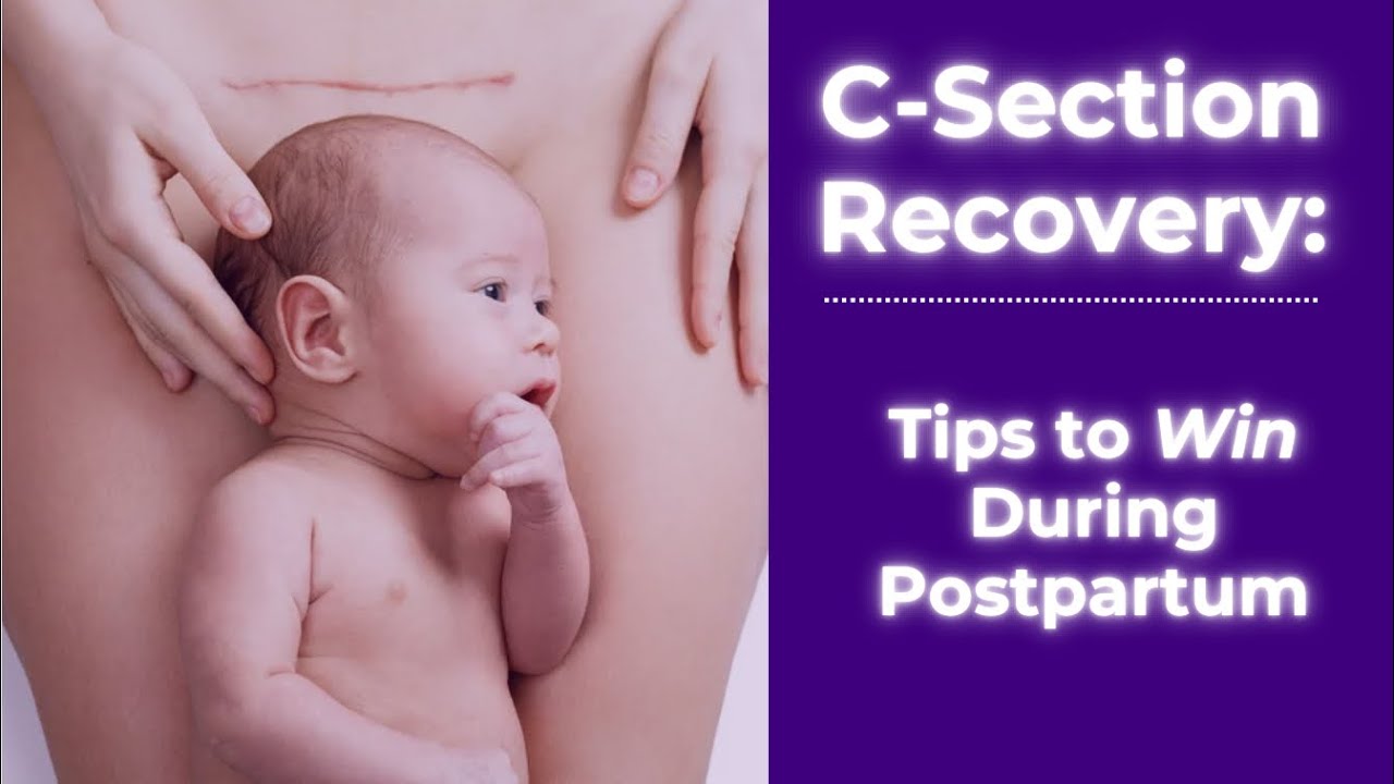 C-Section Recovery Roadmap | Postpartum Recovery Tips | The Birth Prep Lounge | Pregnancy Tips 