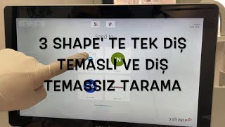 3 Shape Te Tek Diş Temaslı Ya Da Diş Temız Tarama - Kliniğimizde Uyguladığımız Yöntemler