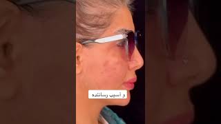 Tips on fat-burning injections for the face