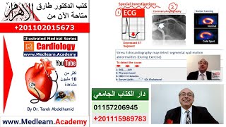Angina Pectoris    #cme #internal_medicine #ecg #usmle #medical #محاضرات_باطنة screenshot 5