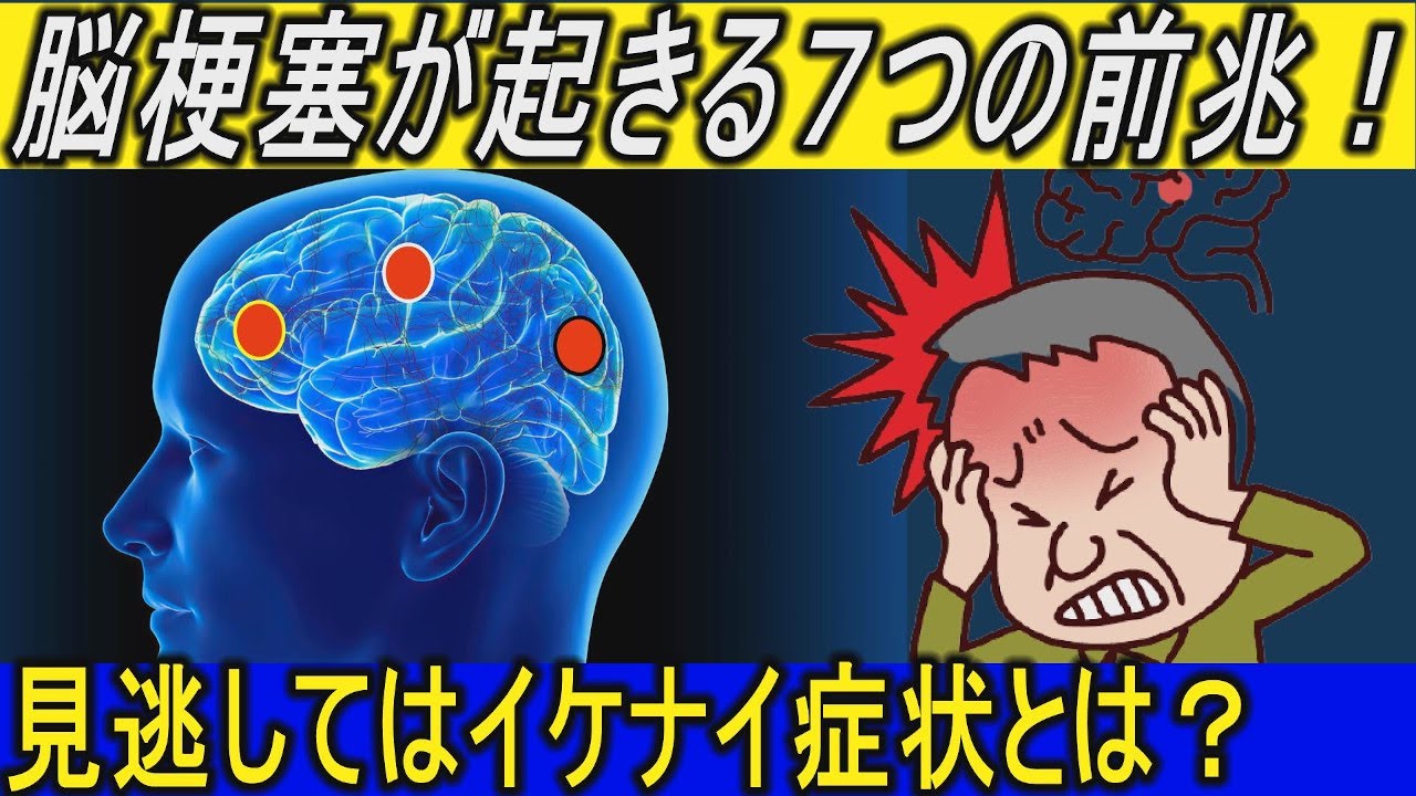 閃輝暗点脳梗塞の前兆 _ 閃輝暗点 治し方 ツボ – YYBY