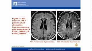 Stroke and Dementia: What Lessons for Us