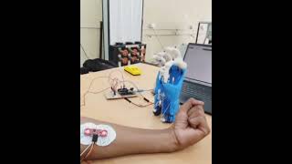 EMG prosthetic hand 🦾 | Final year Mech project#EMG  #ProstheticHand #MechEngg.