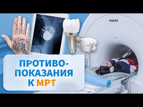 Противопоказания к МРТ. Это может помешать обследованию