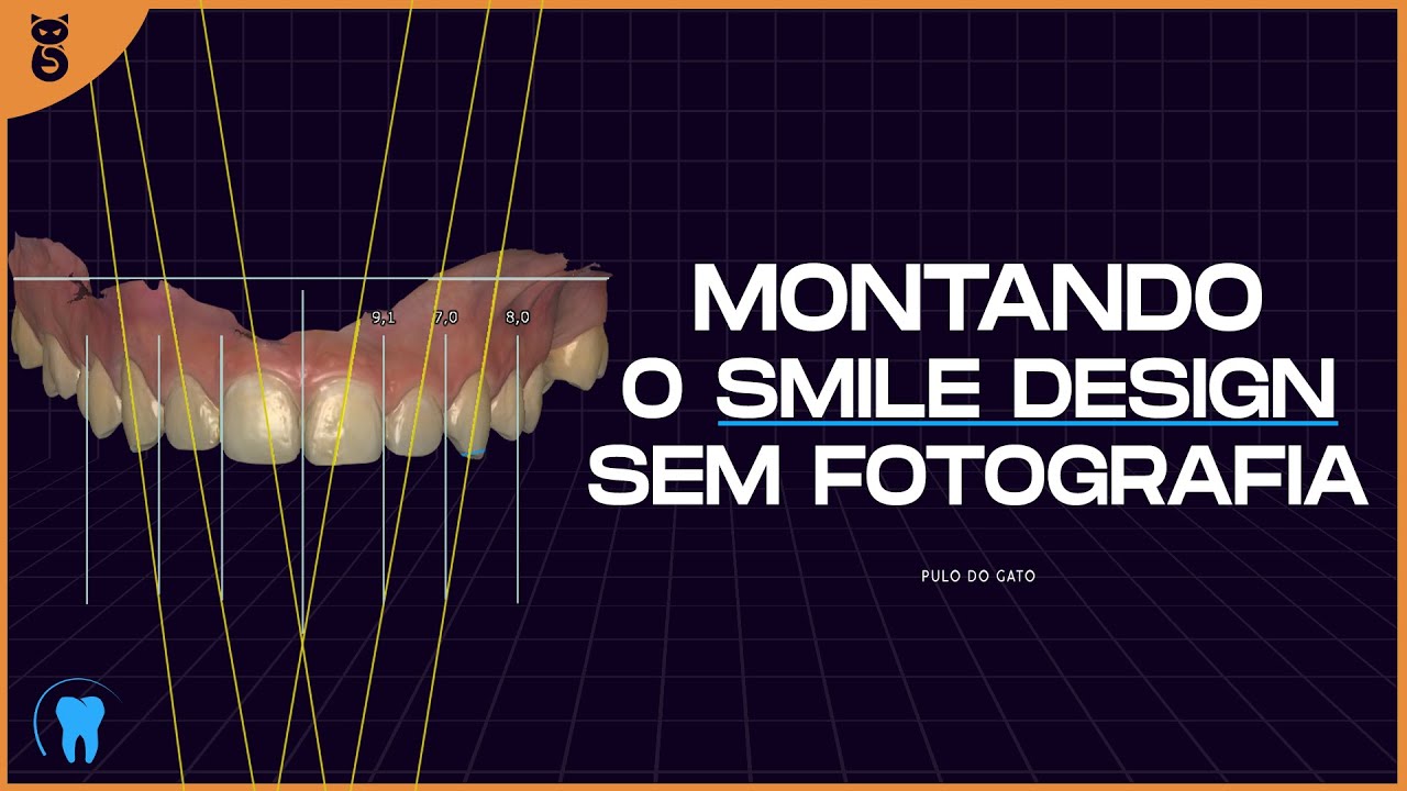 EXOCAD : Montagem do Smile Desing sem foto