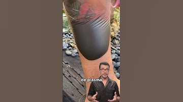 Essa tatuagem deu errado? 😨