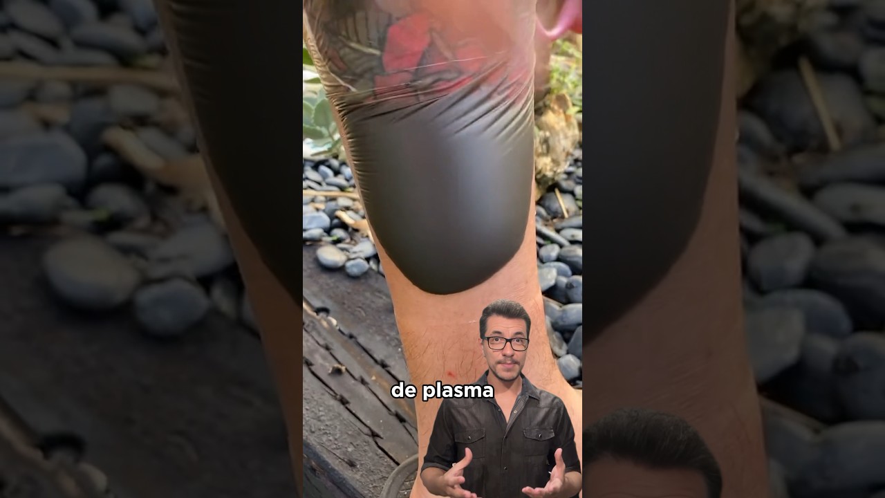Essa tatuagem deu errado? 😨