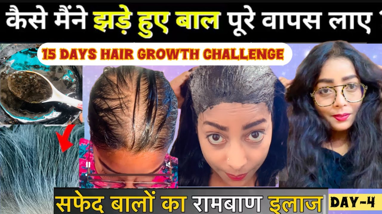 ✨15 Days Hair Growth Challenge👍Day-4*Cure Baldness*🧑‍🦲*Super Healthy Scalp*