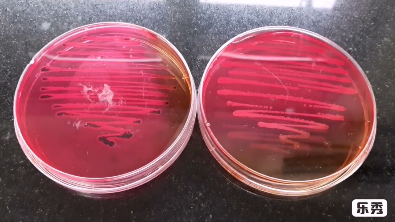 MICROBIOLOGICAL AGAR PLATE | SALMONELLA | XLD AGAR PLATE