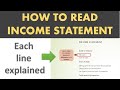 Income statement explained by Line