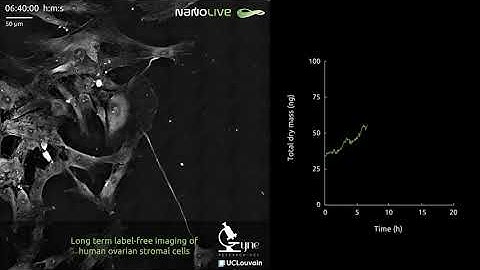 Long term label-free imaging of human ovarian stromal cells