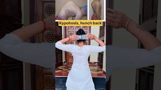 😱😱😱😱😱kyphosis , hunchback, neckhump #ytshorts #healthylifestyle #mudrasbenefits