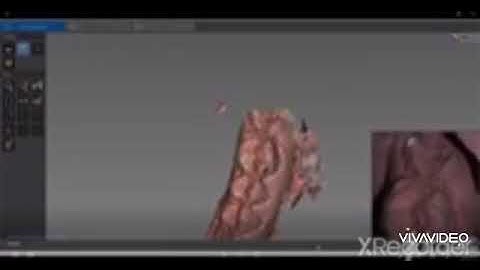 Pre and post operative scan CS3600