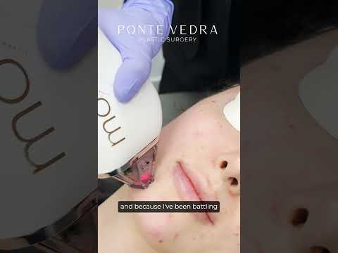 Day in the Life - Moxi BBL Laser