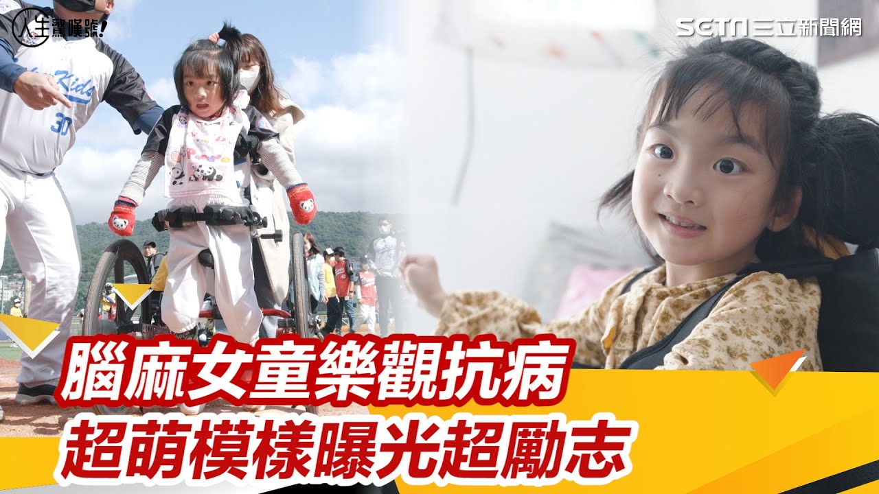 罕病萌妹／做什麼都吃力！腦麻女童樂觀抗病　超萌模樣曝光超勵志│94看新聞